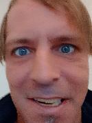 Allandyx