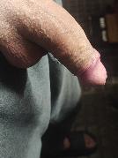 HarterSchwanz18cm sucht Sex Kontakt